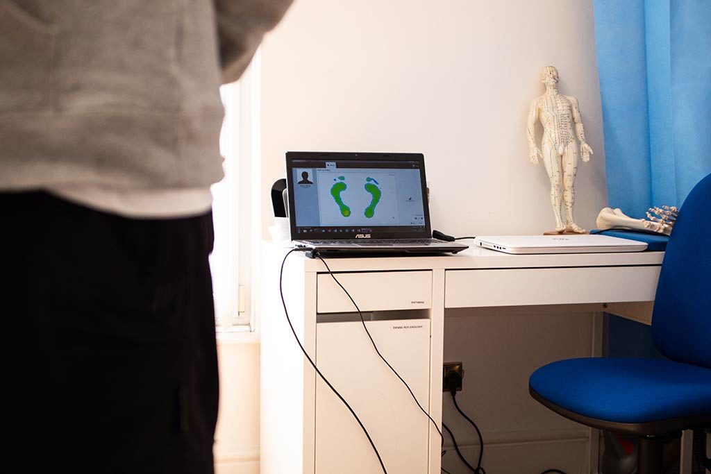 RSscan footscan showing foot pressure and force distribution
